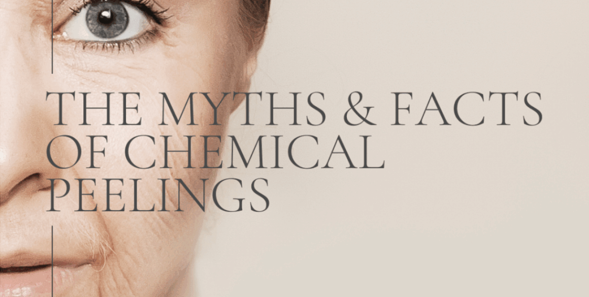 Blog cover week 2 The Myths and Facts of Chemical Peelings