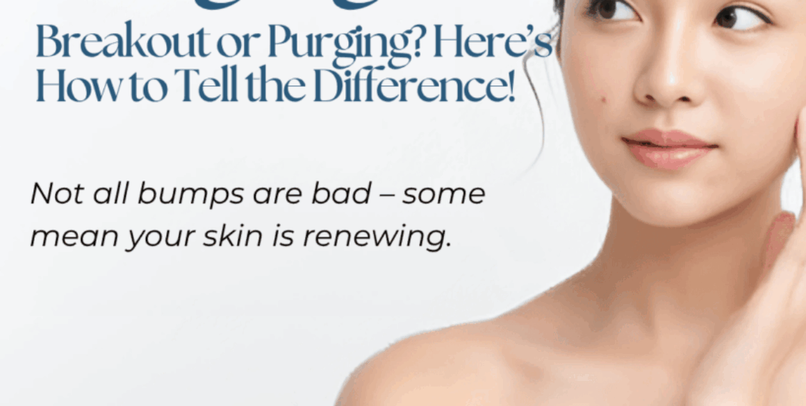 Understanding Skin Purging: What It Really Means for Your Skin