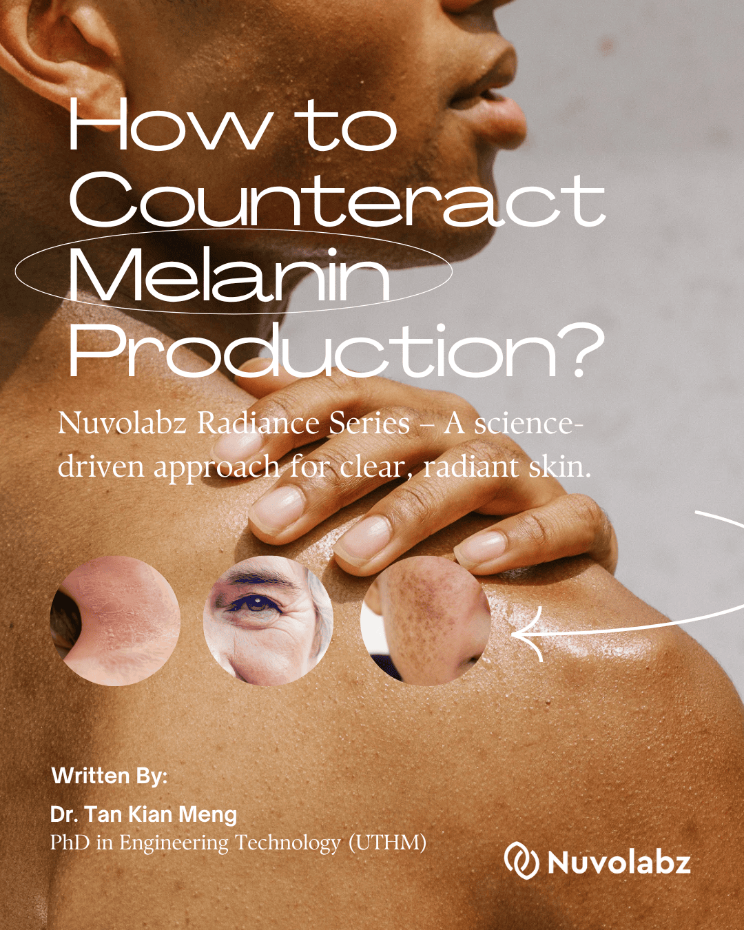 How to Counteract Melanin Production?