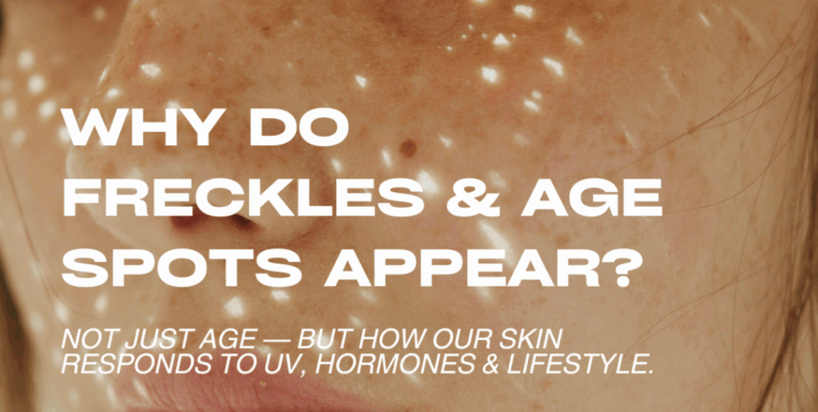 White Brown Photocentric Neutral Clean Beauty Personal Faves Sustainable Beauty Instagram Post Why Are We Getting Freckles and Age Spots?